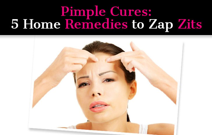 Pimple Cures: 5 Home Remedies to Zap Zits post image